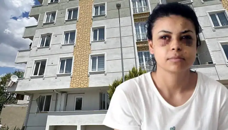 Düğünde Maganda Dehşeti: Mermiler Gözünde Korkunç Yaralar Açtı!