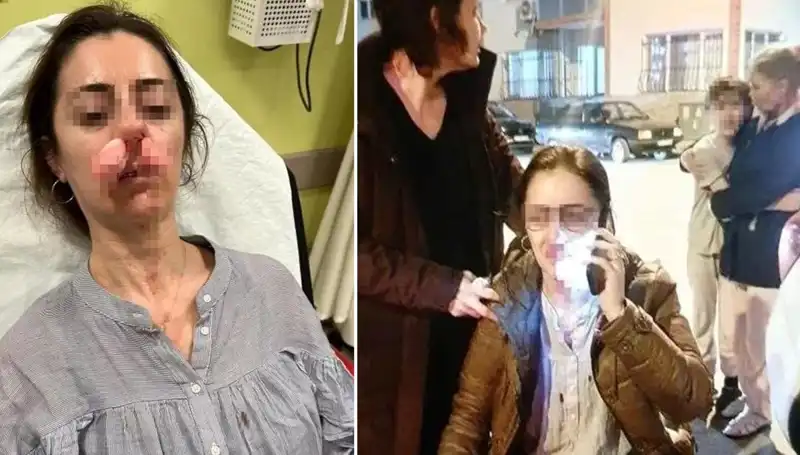 Otomobil Kapısı Artık Silah Sayılıyor! Gözaltına Alındı!