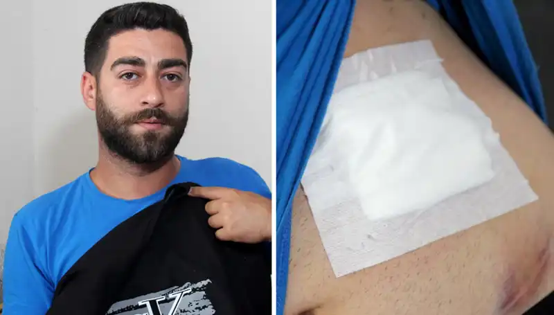 Karnındaki Ağrının Gerçek Nedeni Röntgende Ortaya Çıktı: Şoke Eden Sonuçlar