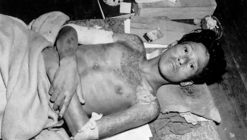 Nagasaki'den Yükselen Ses: Nükleer Tehdit 80 Yıl Sonra Yeniden Gündemde